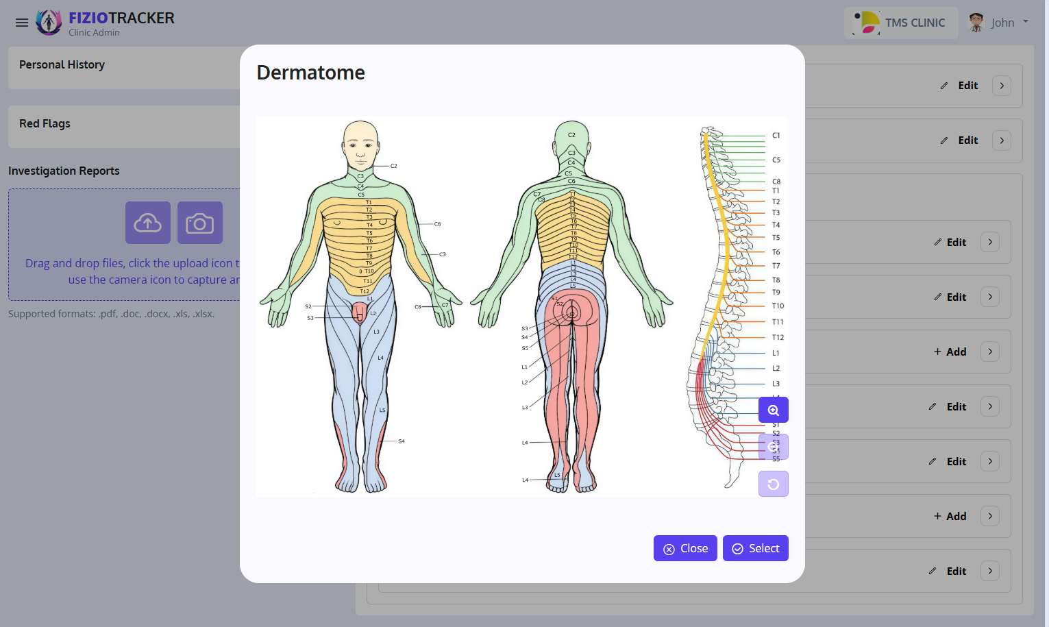 Sensation area selection